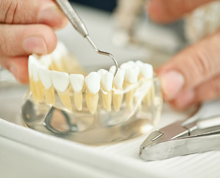 Best Dentures & Partials in Summerville, GA Near Me